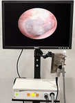 Jedmed Globalmed Hdmi Video Monitor Camera Rigid Otoscope Light Source Stand. Fixed Price $925.00.
